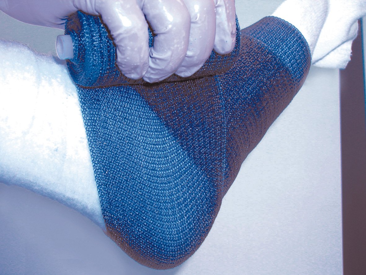 Delta-Lite Plus Light Blue Cast Tape, 4 Inch x 4 Yard MK 653377