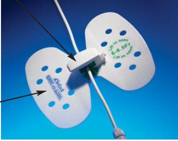 Statlock Universal Plus Drainage Catheter Stabilization Device MK 574085