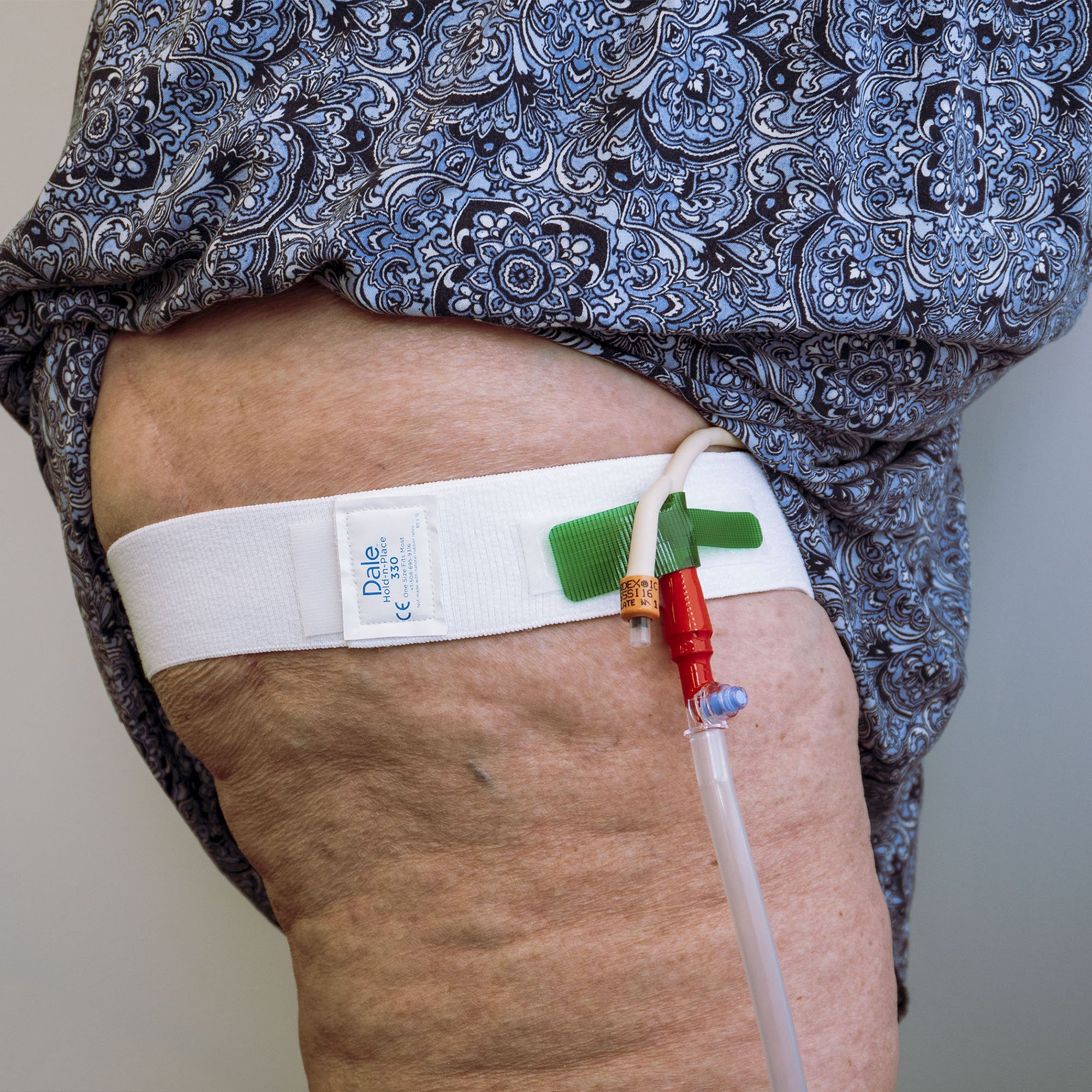 Dale Leg Strap/Waist Band, holds Catheter, fits legs and waists up to 56 Inches MK 934688