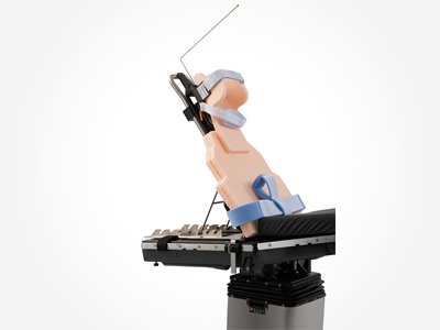 Multiflex Pad Set MK 1057975