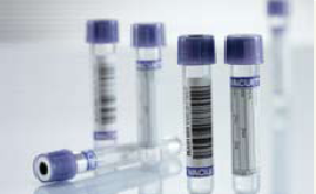 Vacuette Venous Blood Collection Tube, 4 mL, 13 x 75 mm MK 416962