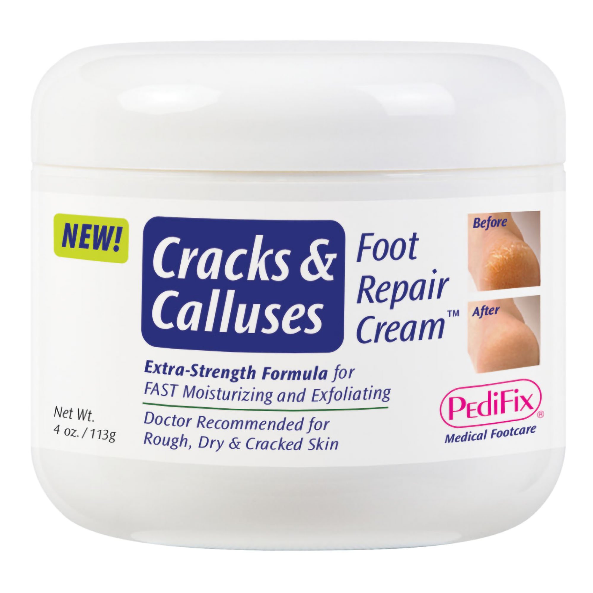 PediFix Cracks and Calluses Foot Repair Cream, 4-ounce Jar MK 1213206