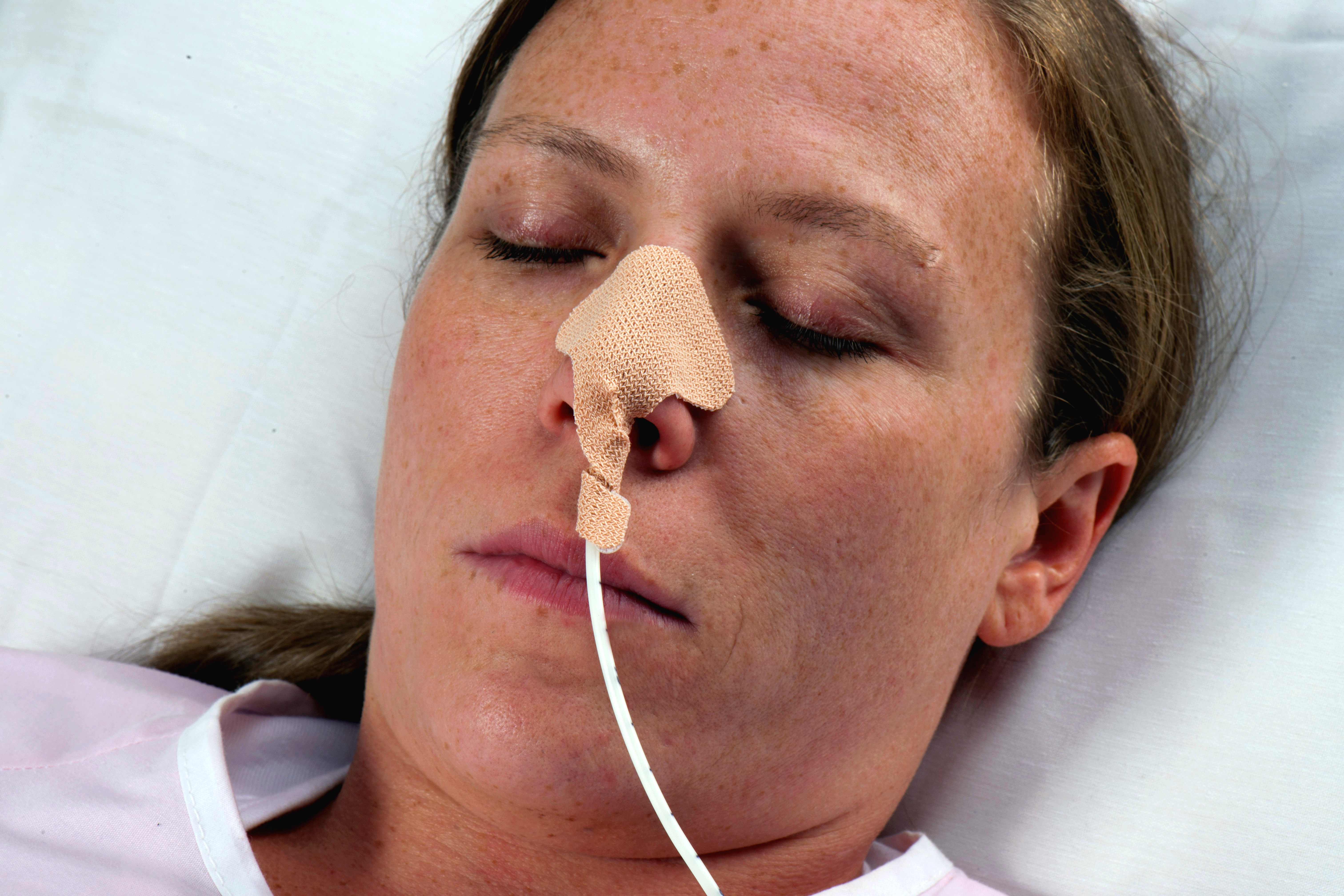 Dale Nasogastric Tube Holder for Nasogastric Feeding and Aspiration Tubes MK 478717