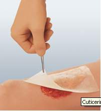 Cuticerin Oil Emulsion Impregnated Dressing, 3 x 8 Inch MK 554929