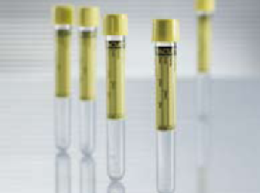 Vacuette Urinalysis Tube, 9 mL, 16 x 100 mm MK 470580