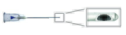 SteriGlide Aesthetic Microcannula, 25 Gauge, 1-1/2 Inch MK 971438