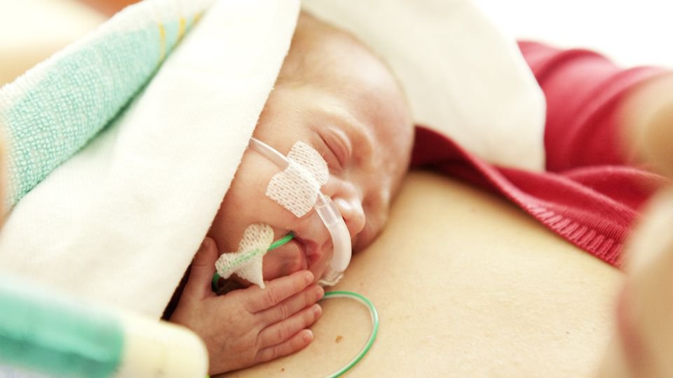 NuTrio G-Tube Extension Set MK 994207