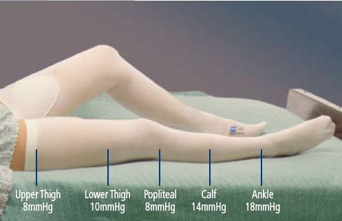 T.E.D. Knee High Anti-embolism Stockings, 2X-Large / Regular MK 717768