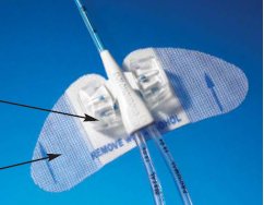 Statlock PICC Plus Central Venous Catheter Stabilization Device MK 535672