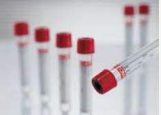 Vacuette Z Serum Clot Activator Venous Blood Collection Tube, 9 mL, 16 x 100 mm MK 385924
