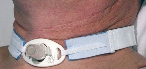 AirLife Tracheostomy Tube Holder MK 724209