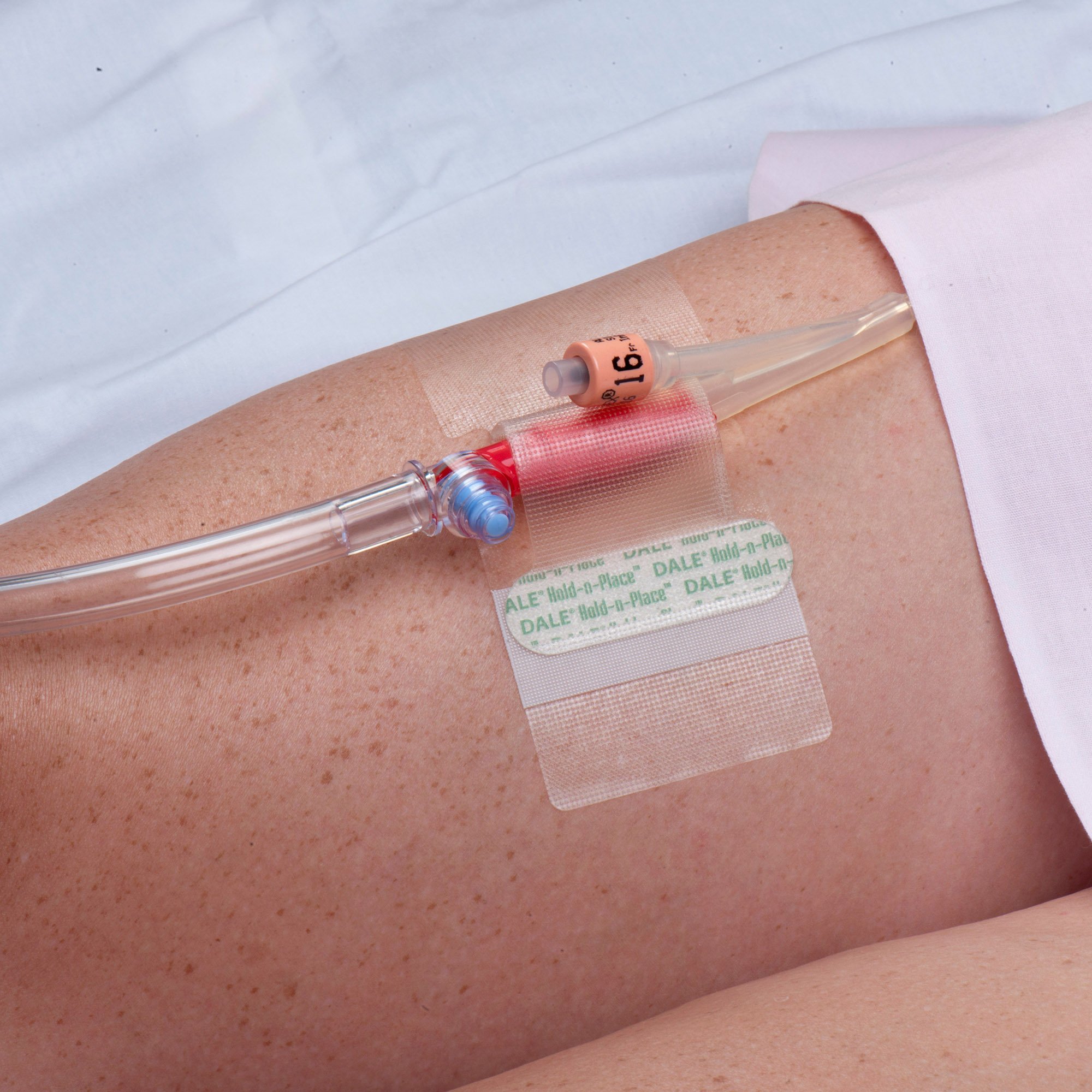 Dale Hold-n-Place Catheter Holder MK 697965