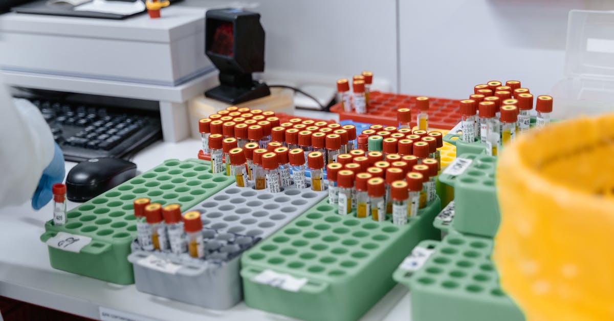 Blood samples in a lab, ready for testing and research. Organized for efficient processing.