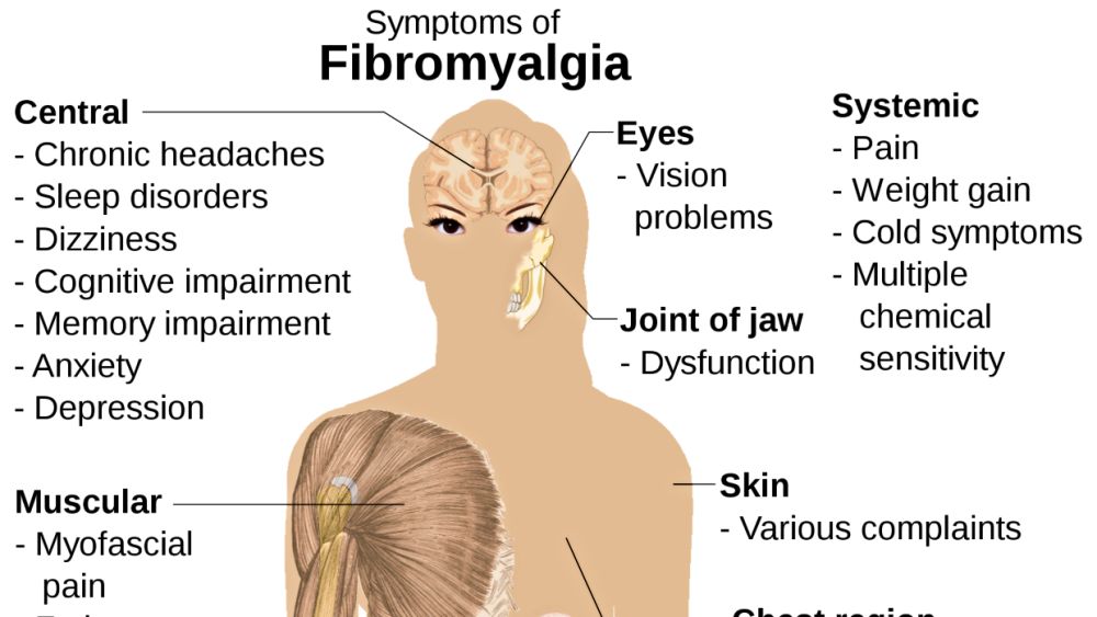 Fibromyalgia - Troubling for Sufferers and for Their Doctors