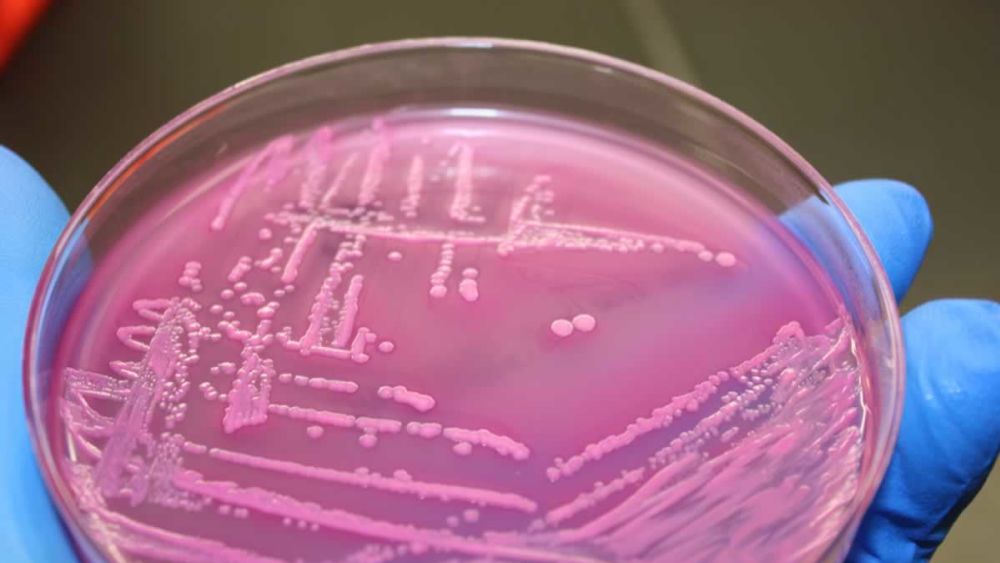 E.Coli Outbreaks - Preventable or Fact of Life?