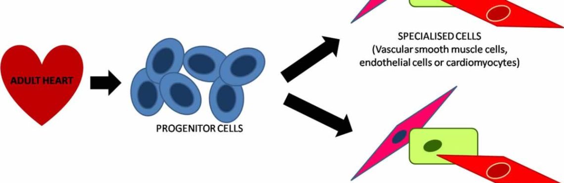 Stem Cell Therapy - Ready for Prime Time?