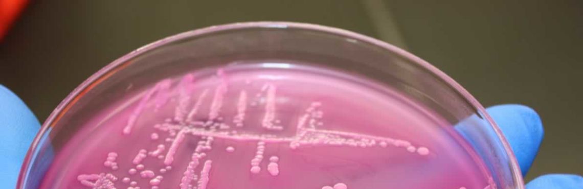 E.Coli Outbreaks - Preventable or Fact of Life?