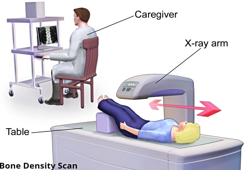 Bone Density Test