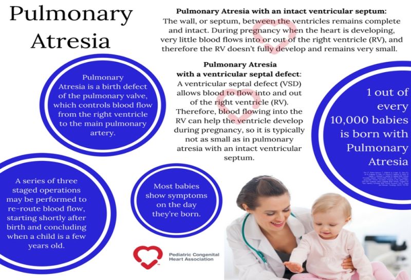 Pulmonary Atresia