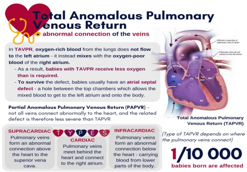 Total Anomalous Pulmonary Venous Return (TAPVR)