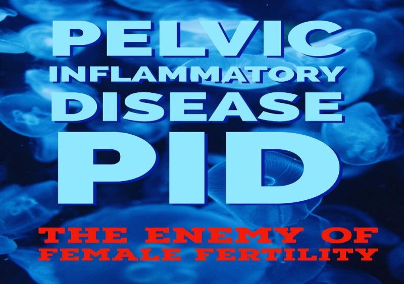 PID (Pelvic Inflammatory Disease)