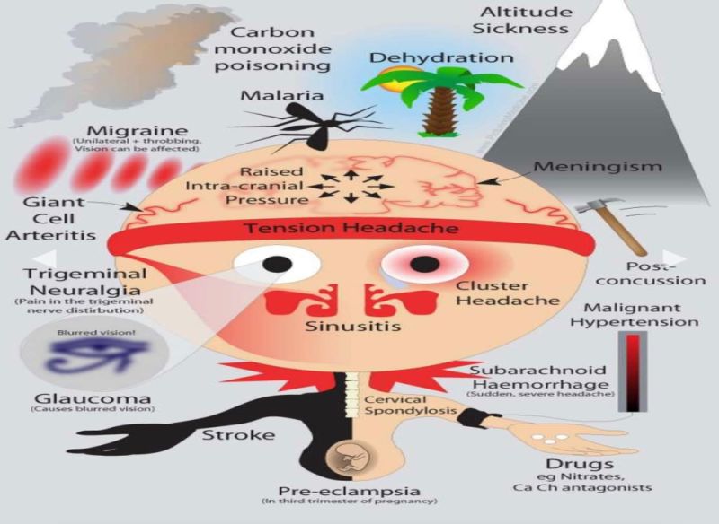 Facial Pain