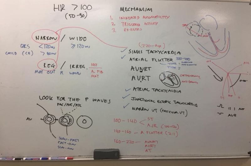 Tachydysrhythmias