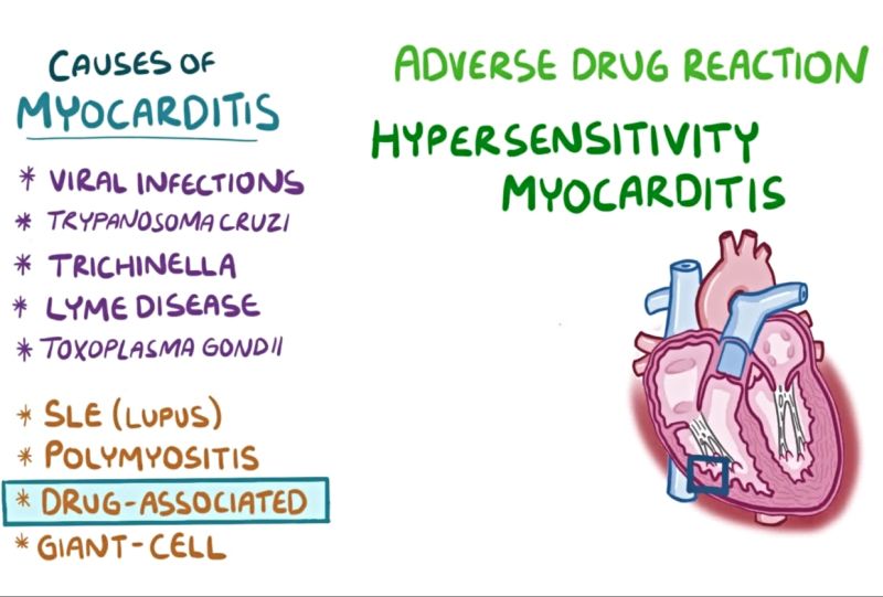 Myocarditis