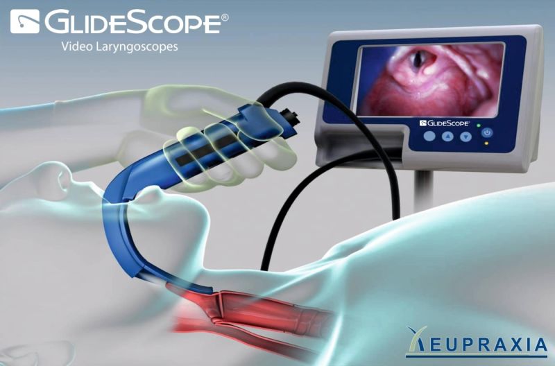  GlideScope