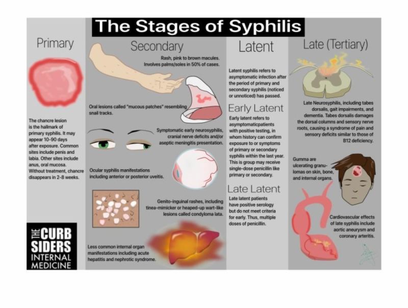 Syphilis