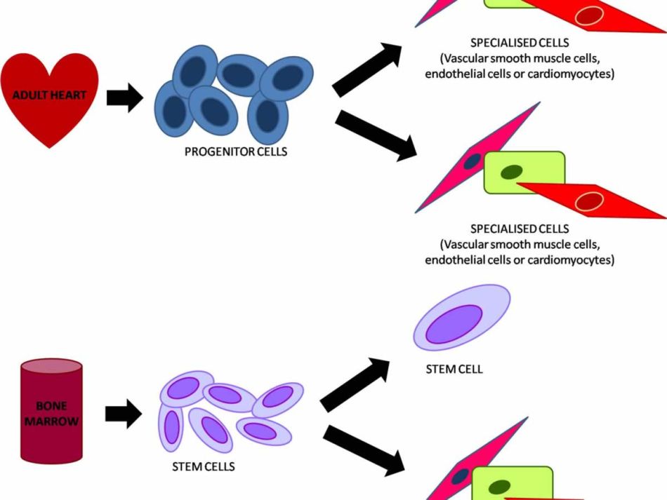 Stem Cell Therapy - Ready for Prime Time?