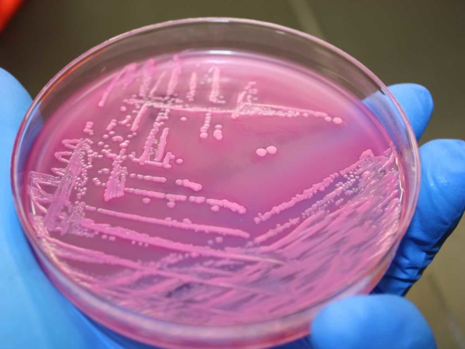 E.Coli Outbreaks - Preventable or Fact of Life?