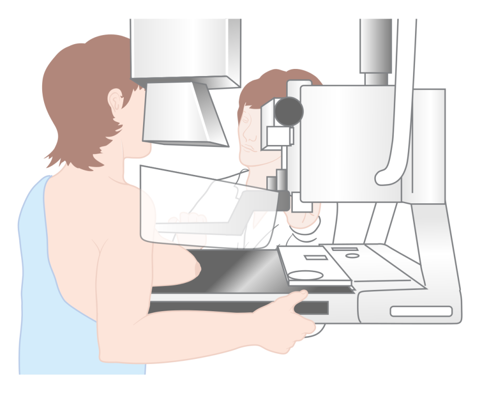 Time for Mammograms to Be a Thing of the Past?