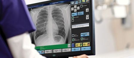 Carestream Digital X-ray System Receives Top Award  