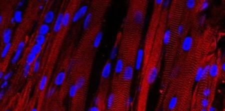 Researchers Grow First Contracting Human Muscle in Laboratory