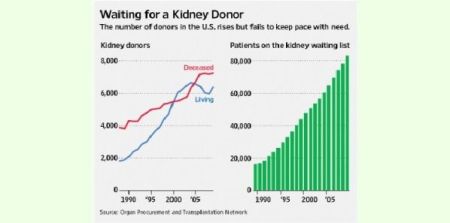 Organ Donors Who Need Kidneys Go to Top of Transplant List