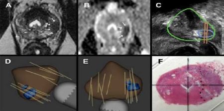 How 3D Printing is Reshaping Medical Practice