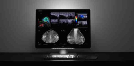 Barco Launches Breast Imaging and PACS Display  