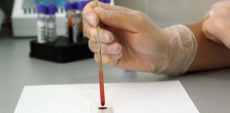 Single-Drop Blood Test For Colorectal Cancers