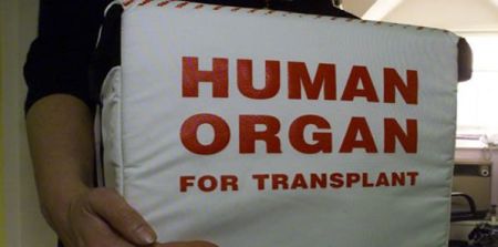 CIT No Barrier to Broader Organ Sharing 