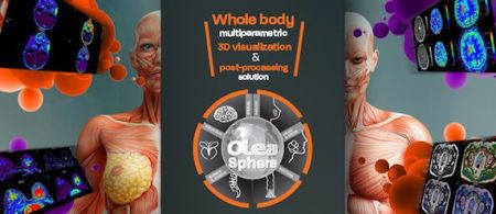 Olea Sphere Medical Imaging Software is Granted USFDA Approval 