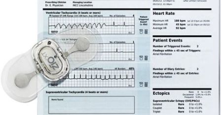 Study: Traditional Holter Monitor Outperformed by ZIO Service Arrhythmia Detection