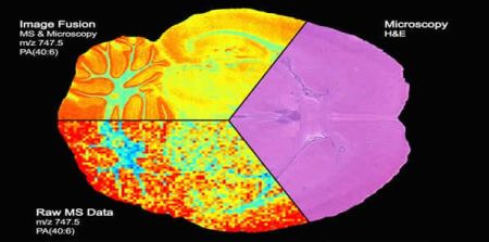 First Image Fusion of Mass Spectrometry and Microscopy