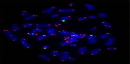 Researchers Extend Telomeres in Human Cells to Slow Ageing