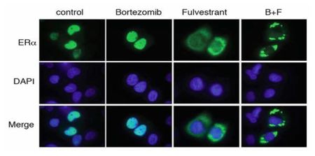 Drug Combination Delays Progression of Breast Cancer