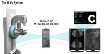 RSNA 2014: VuCOMP Showcases Industry-Leading Computer Vision Systems for Breast Cancer Detection