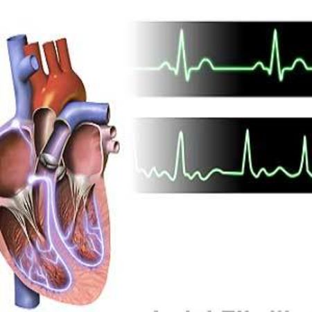 First Consensus Paper on Atrial Cardiomyopathies 