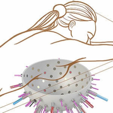 Dream Imager for Breast Cancer Diagnosis