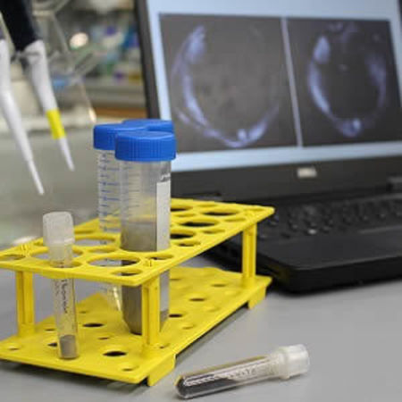 The novel contrast agent (grey solution in larger tube), developed using nanodiamonds in combination with a manganese base, provides clearer and more accurate images of liver tumours at lower dosages.