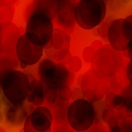 Managing bleeding on OACs - new expert consensus